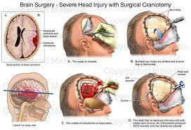 Dr. Prashant Khandelwal - Brain & Spine Trauma Surgeon, Pune