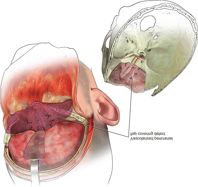 Craniofacial Tumour Surgeries by Dr. Prashant Khandelwal